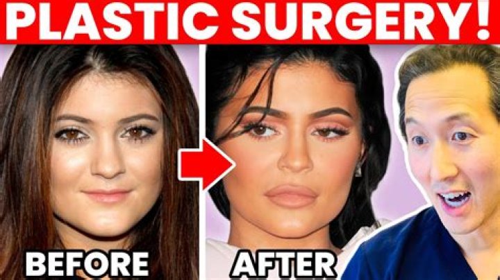 Ari from 90 Day Fiancs plastic surgery rumours explored Mon 25 October 2021 11:03 Helen